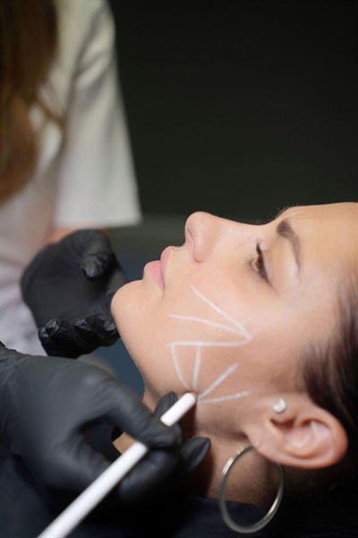 Estética
